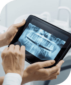 Diagnosis | Smile Select Dental