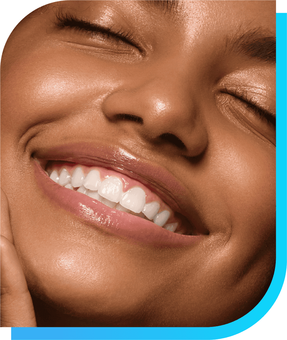 What is Dental Bonding | Smile Select Dental