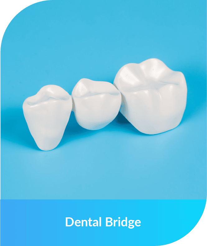 Dental Bridge | Smile Select Dental