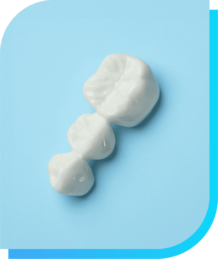 What is a Dental Bridge | Smile Select Dental