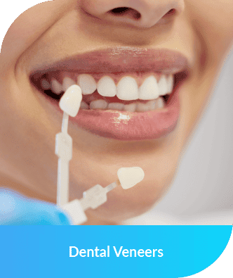 Dental Veneers | Smile Select Dental