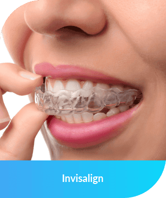 Invisalign | Smile Select Dental