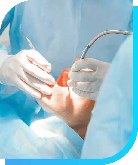 What is Oral Surgery | Smile Select Dental