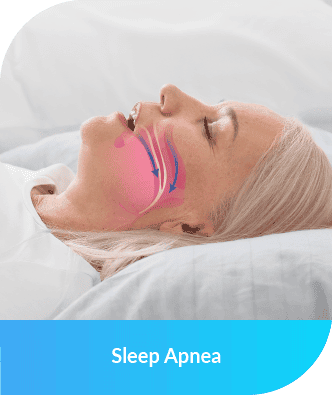 Sleep Apnea | Smile Select Dental